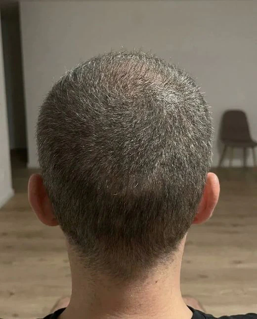 Customer crown after