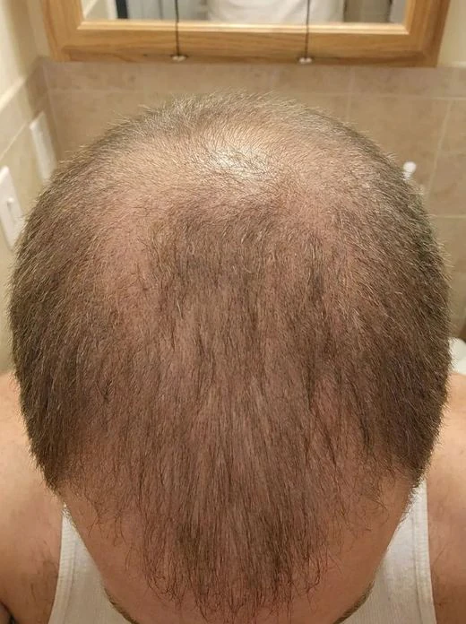 Customer crown, day 0