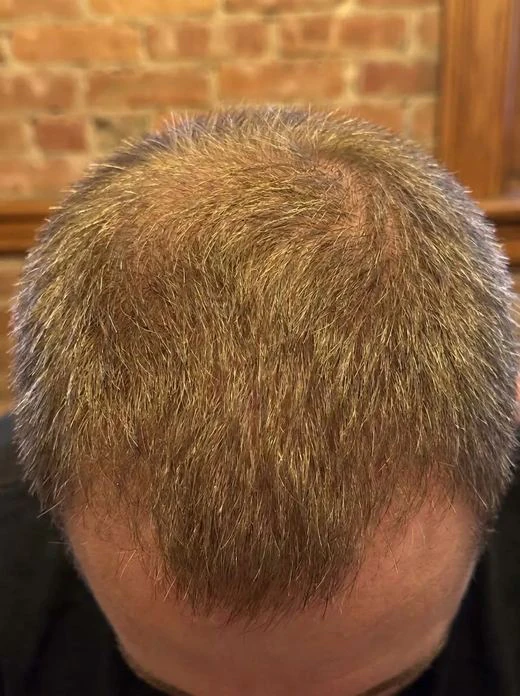 Customer crown, month 6